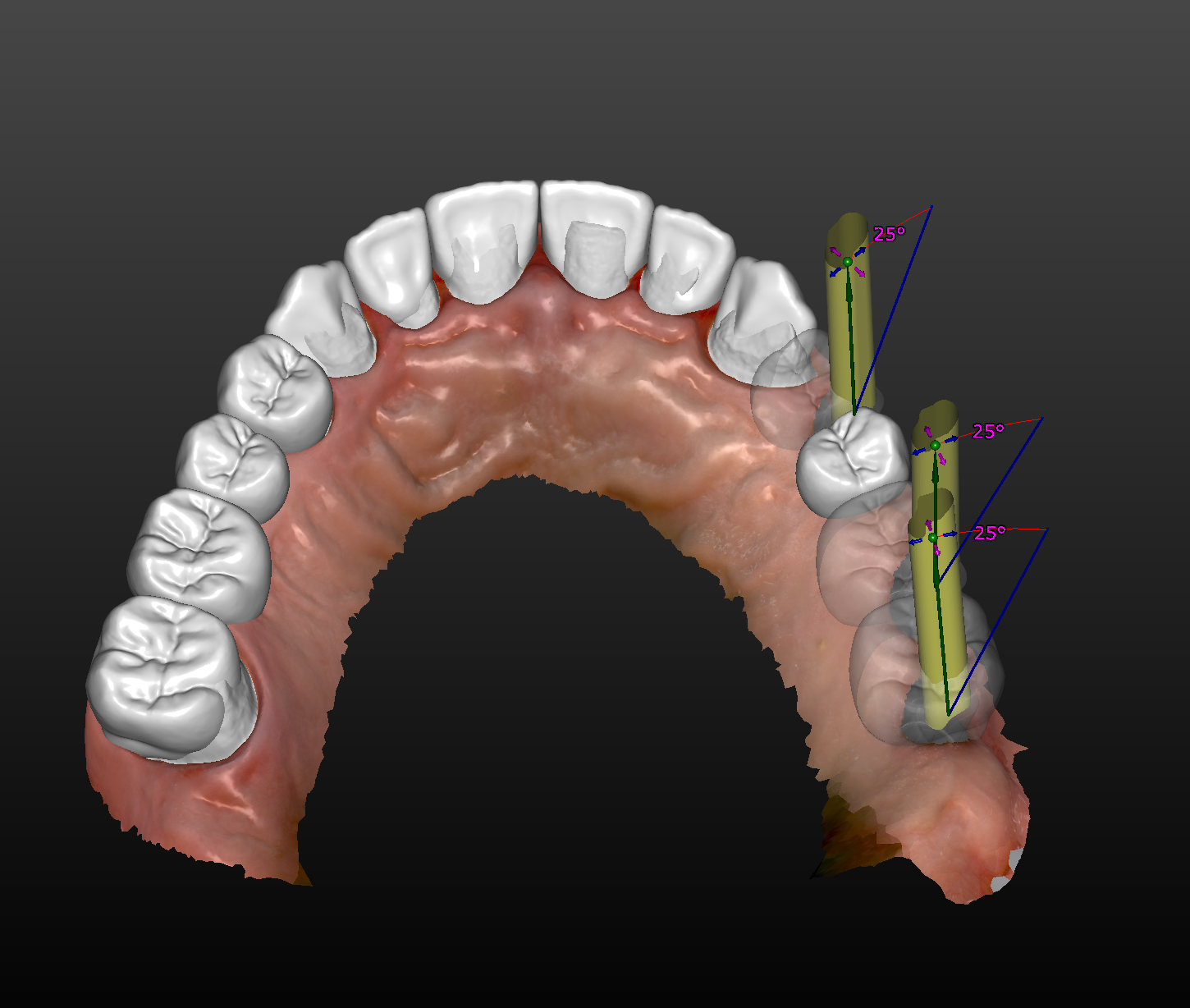 Dijital Diş Hekimliği